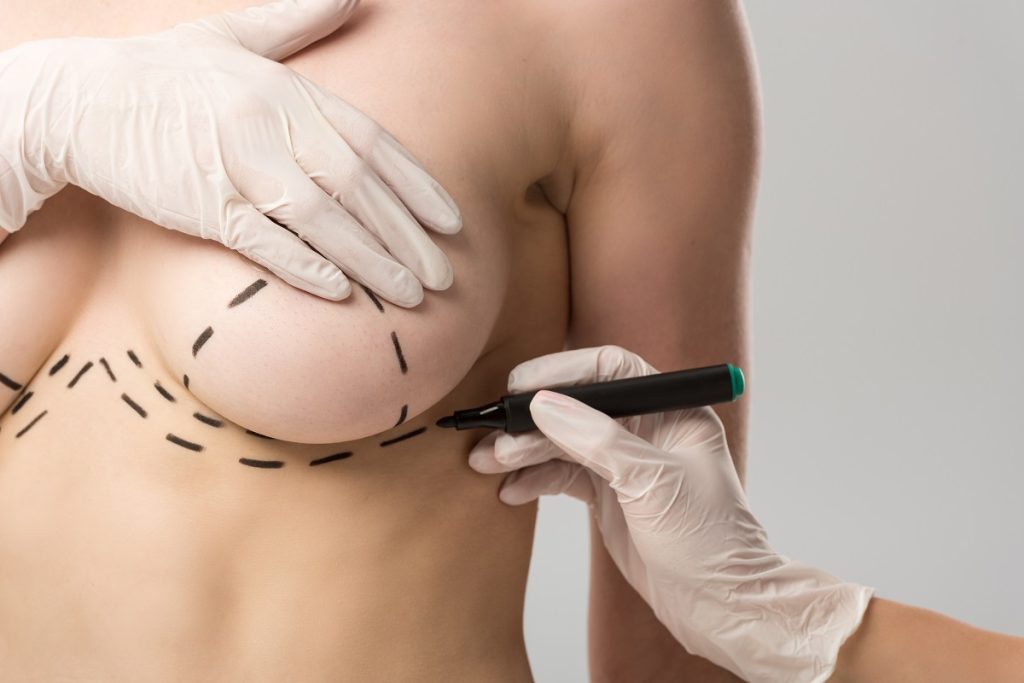 breast lift procedure in south florida